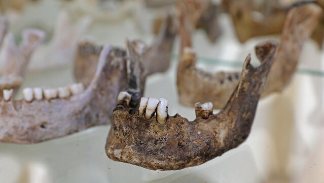 Human skull and traces of crime. Bones are like evidence.