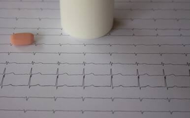 Heartbeat represented on paper. Electrocardiogram with selective focus. Representation of cardiac arrhythmias.