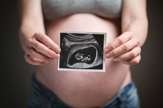 Pregnant Woman Holding a Sonogram or Ultrasound Picture of Her Baby