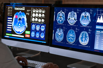Male neurologist with MRI scan of human head on screen of computer monitor in clinic