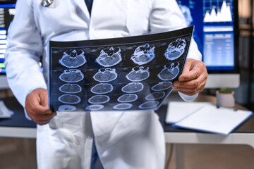 Senior neurologist with MRI scan of human head in clinic