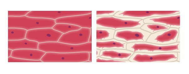 Plasmolysis in onion epidermis cells - obrazy, fototapety, plakaty