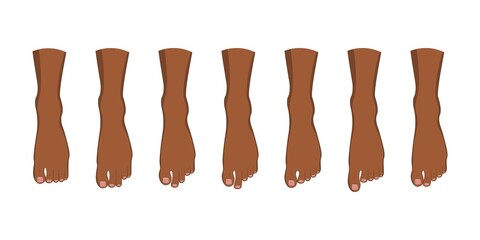 Foot toe shape types set.