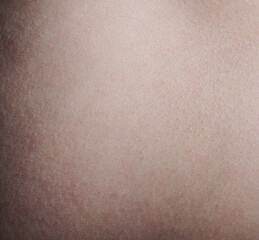 Surface of human skin background