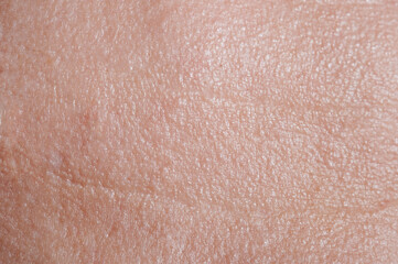 Fototapeta premium Skin on forehead with wrinkles