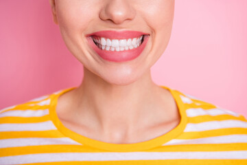 Closeup cropped facial expression photo of attractive lady demonstrating perfect white toothy beaming smile dentistry concept wear casual yellow striped shirt isolated pink color background