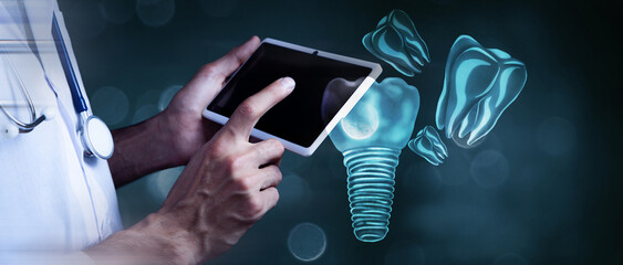 studied tooth implant .3d illustration