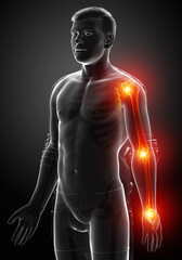 Obraz na płótnie Canvas 3d Illustration of men arm joint pain