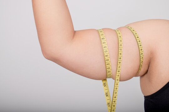 Asian women are overweight. She measuring arms girth with measure tape.
