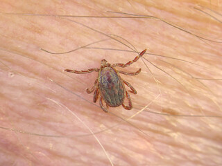 Tick on human hairy skin background. Ixodes ricinus or scapularis. Dangerous parasitic mite on blurry pink texture. Disgusting biting insect. Encephalitis infection. Tick-borne diseases 