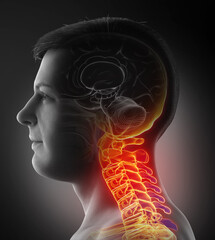 3d rendered, medically accurate illustration of male   having a painful neck