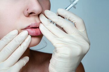 
Beautiful woman with a bruise on her lips after lip augmentation with hyaluronic acid. Injection...