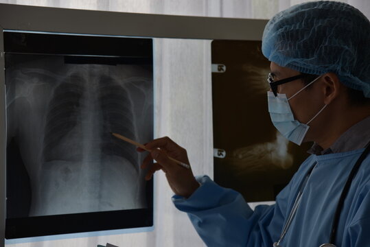 Asian male doctor is watching image of  X-ray film viewer of Patient for a physical examination anatomy