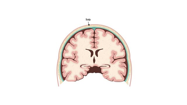 Human brain. Healthy and brain with Alzheimer's disease