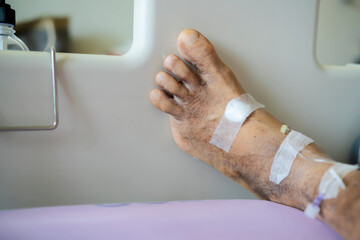 Diabetic patients were cut off the little finger. Recuperate at the hospital trying