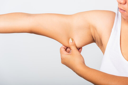 Close up of Asian woman pulling excess fat on her under arm, problem armpit skin, studio isolated on white background, Healthy overweight excess body concept