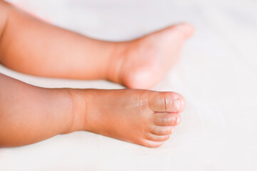 Obraz na płótnie Canvas Baby legs With White Background
