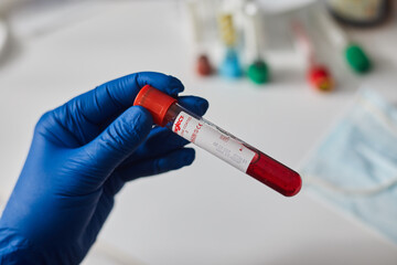 Doctor scientist holding test tube with blood for 2019-nCoV analyzing. Novel Chinese Coronavirus blood test Concept. Blood Sample Vaccine research.