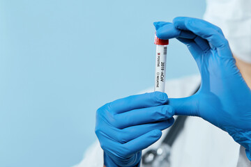 Coronavirus 2019-nCoV Blood Sample. Doctor scientist in protective gloves, mask and glasses holding test tube with blood for 2019-nCoV analyzing. Coronavirus blood test Concept. Vaccine research
