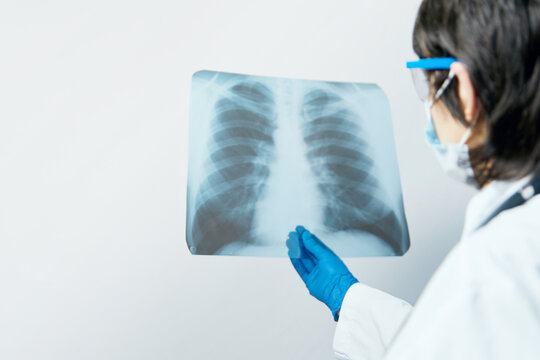 Medical doctor looking through x-ray picture of lungs for  viral pneumonia of a Covid-19 patient in the clinic in hospital. Coronavirus concept