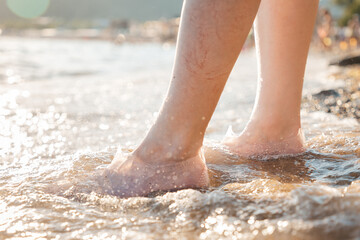 Varicosity. A woman stands on the beach in the water and shows a vascular mesh on the lower leg. Legs close-up. The beach is in the background