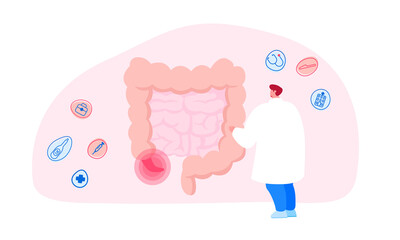 Doctor or Medic Character Stand at Huge Human Intestines with Sore Appendix Infographics Aid Decide Strategy of Treatment. Abdominal Pain, Gastrointestinal System Disease. Cartoon Vector Illustration