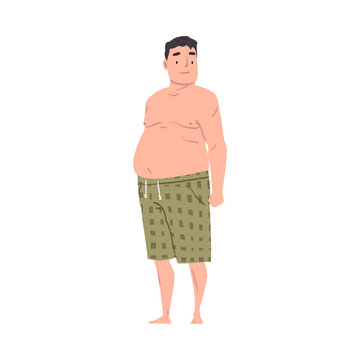 Fat Overweight Man with Big Belly, Obese Man in Shorts Cartoon Style Vector Illustration on White Background