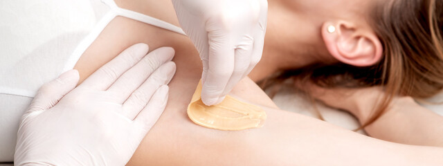 Hand of cosmetologist applying wax paste on armpit. Depilation or epilation female armpit with...