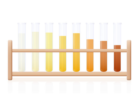 Urine color chart. Test tubes with clear, yellow, orange and even darker urine as an indicator of the level of dehydration, and a reminder to drink more water. Vector on white.
