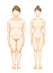 Illustration of two women with different figures. Female full body shape in flat style, front view. Set of bodies before and after weight loss.