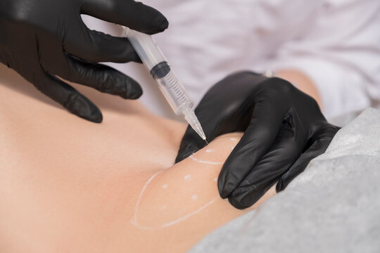 Lipolytic Images – Browse 1,212 Stock Photos, Vectors, and Video | Adobe  Stock