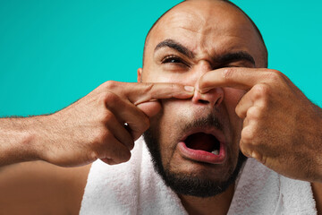 Close-up portrait of a black man squeeze a pimple on his face
