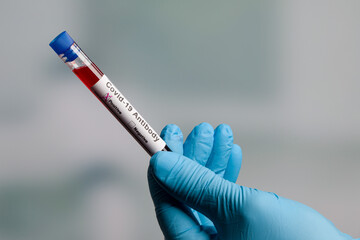 Close up of hands in medical gloves holding a test tube after virus analysis with coronavirus...