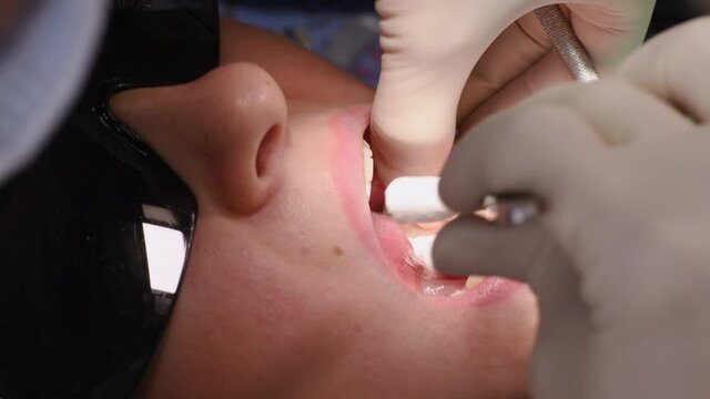 Drying mouth and teeth from saliva with cotton wools. Young woman at dental clinic. Female dentist with assistant treating cavities in a patient mouth in modern dental office.