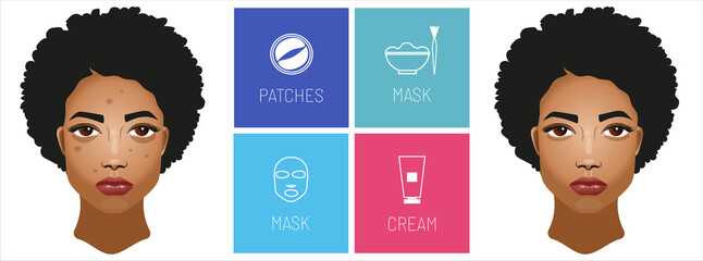 Girl with dark skin, skin care products.Treatment beauty. Problems on the skin pimples and acne, and dark circles under the eyes. Types of cosmetics masks, patches under the eyes and cream. 