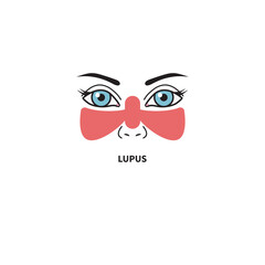 Systemic lupus erythematosus. Woman with red spot on her face