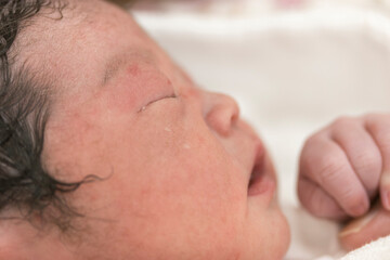 出産直後の新生児の横顔