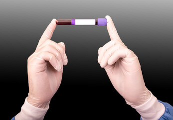 Blood test sample for presence detection of virus Covid-19 or Coronavirus in the hands of doctor on black and white background, space for text on the test tube label