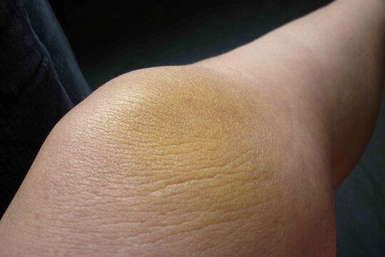 Knie