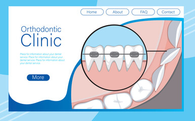 Website layout with services for installing braces and aligning teeth, molars, vector stock illustration as a website template with braces