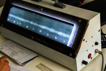 The radiography film operator level 2 evaluation  radiographs of the welds with viewer and he is...