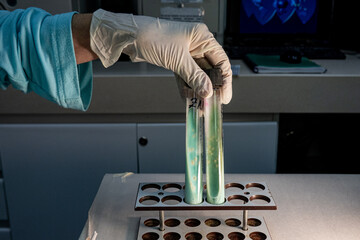 Acid fast bacilli in culture tubes with Mycobacterium Tuberculosis