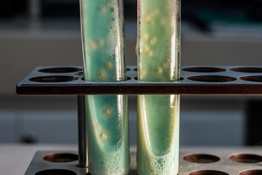 Acid fast bacilli in culture tubes with Mycobacterium Tuberculosis