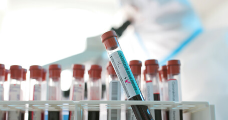 blood test result for Coronavirus
