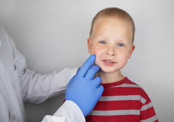 An allergist or dermatologist examines red spots on a child’s face. The boy suffers from a rash,...