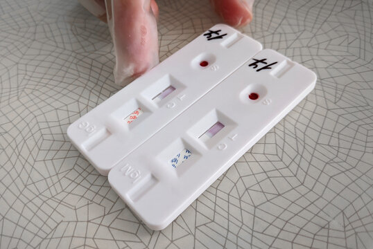 Express COVID-19 test for IgM and IgG antibodies to novel coronavirus SARS-CoV-2, Covid-19 , view from the patient’s eyes - Powered by Adobe