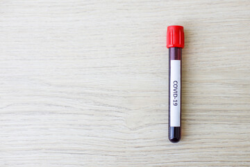 Exam blood in test tube on table with copy space.