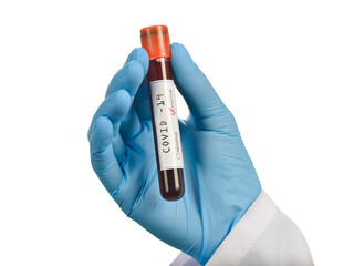 Obraz premium Blood sample tested COVID-19 positive on medical assistant's hand isolated on white background. 