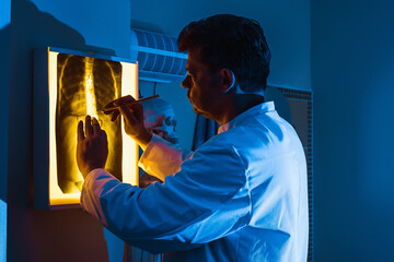 A doctor in a white robe examines an X-ray of the lungs or chest in neon light. A concept on the...