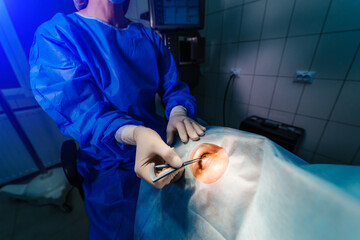 Medical specialist performing surgery ophtalmology operation. Modern equipment. Vision correction.